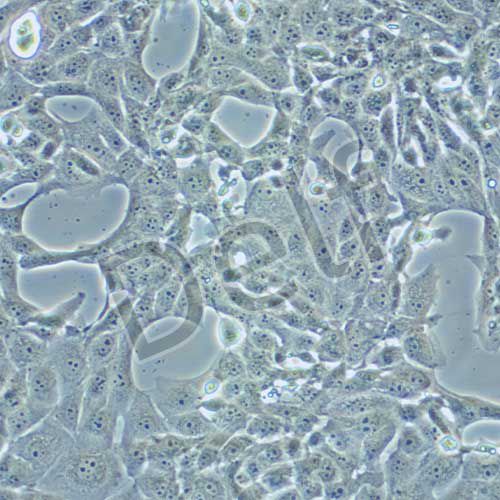 MDBK NBL-1 牛腎細胞