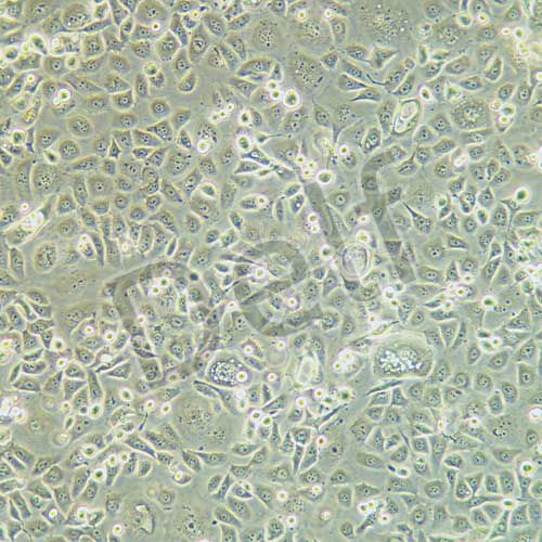 ME-180 人子宮頸表皮癌細(xì)胞