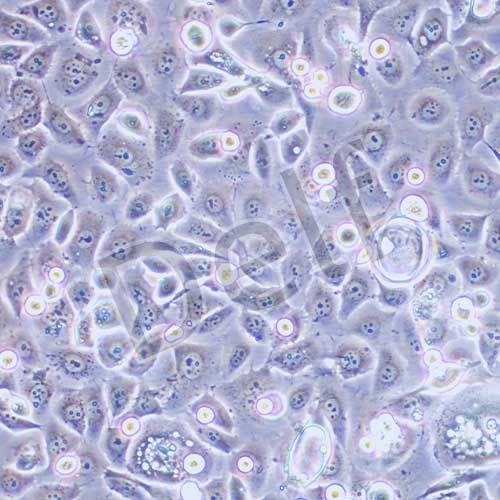 ME-180 人子宮頸表皮癌細(xì)胞