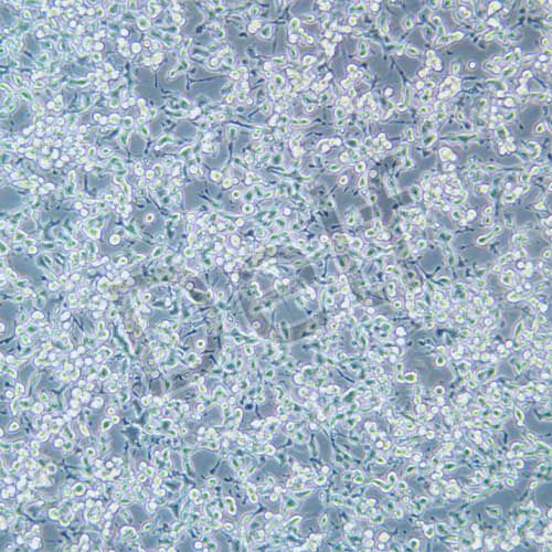 MFC 小鼠前胃癌細(xì)胞