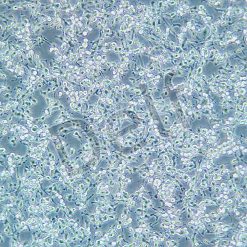 MFC 小鼠前胃癌細(xì)胞