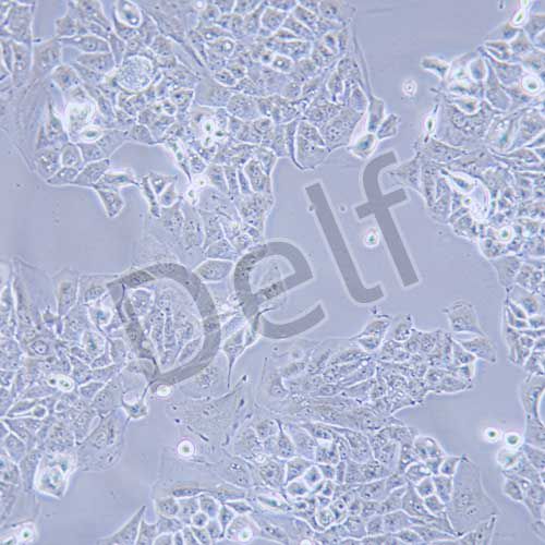 MHCC-97H 人高轉(zhuǎn)移性肝癌細(xì)胞