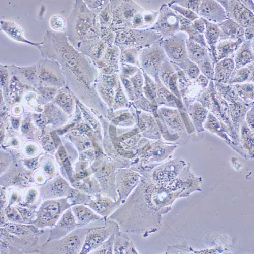 MHCC-97H 人高轉(zhuǎn)移性肝癌細(xì)胞