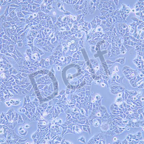 MHCC-97L 人低轉(zhuǎn)移性肝癌細(xì)胞