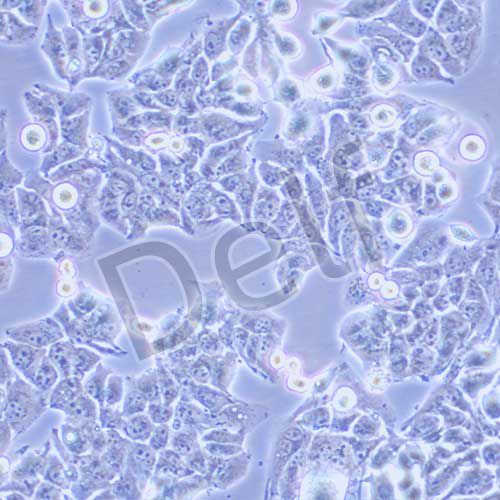 MHCC-97L 人低轉(zhuǎn)移性肝癌細(xì)胞