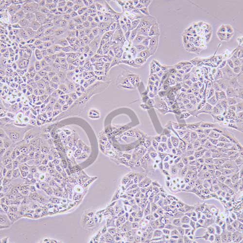 MKN-74 人胃癌細(xì)胞