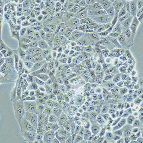 MKN-74 人胃癌細(xì)胞