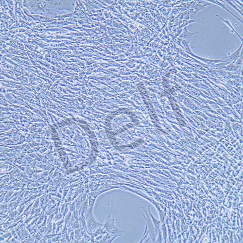 MLO-Y4 小鼠骨樣細(xì)胞(本株不供應(yīng))