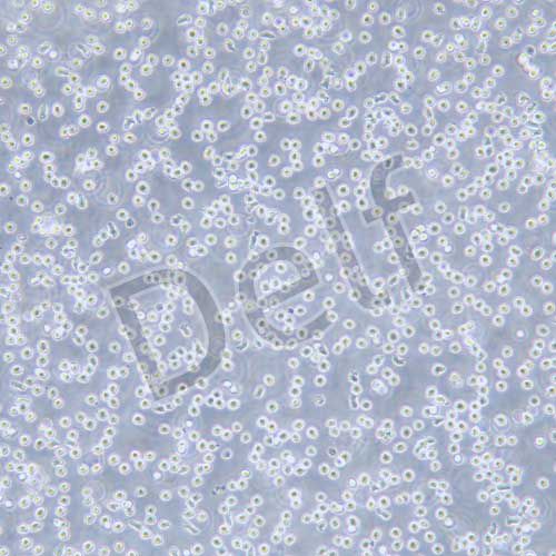 MOLT-4 人急性淋巴母細(xì)胞性白血病細(xì)胞