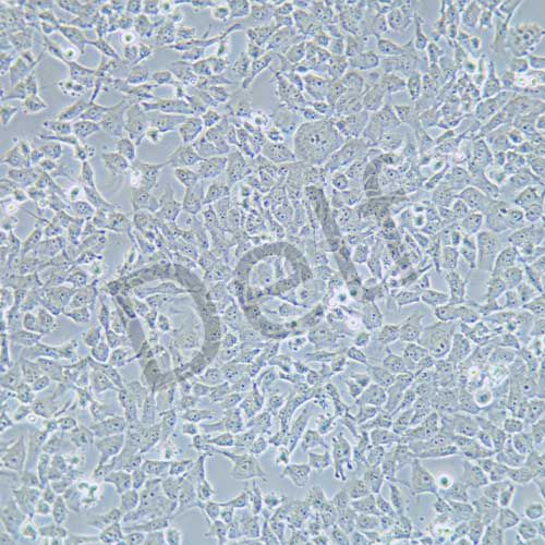 MUM2B 人侵襲性脈絡膜黑色素瘤細胞