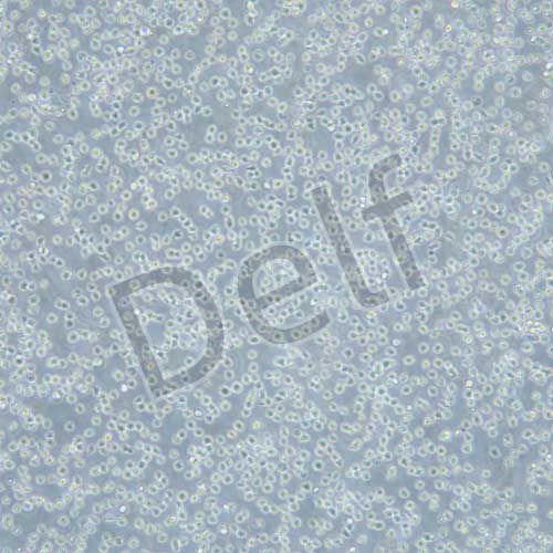 NALM-6 人B淋巴白血病細(xì)胞