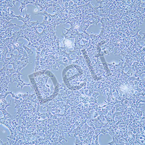 NCCIT 人畸胎癌細(xì)胞