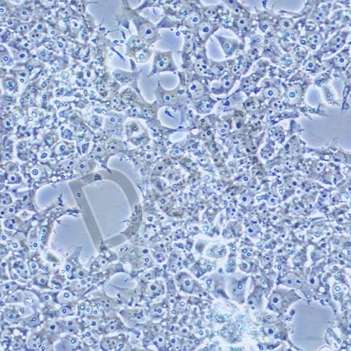 NCCIT 人畸胎癌細(xì)胞