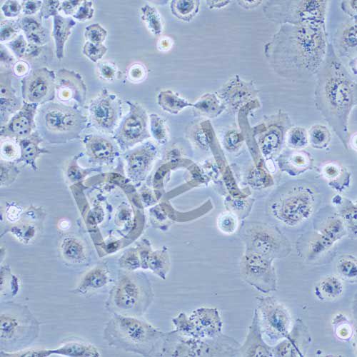 NCI-H23 人非小細胞肺癌細胞