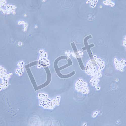 NCI-H82 人小細(xì)胞肺癌細(xì)胞