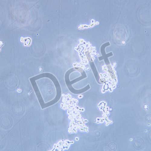 NCI-H82 人小細(xì)胞肺癌細(xì)胞