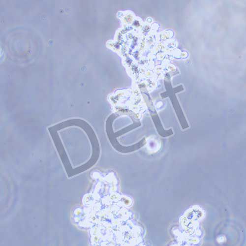 NCI-H82 人小細(xì)胞肺癌細(xì)胞