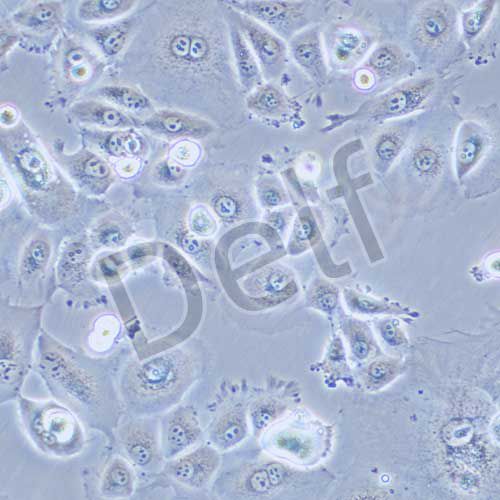 NCI-H226 人肺鱗癌細(xì)胞