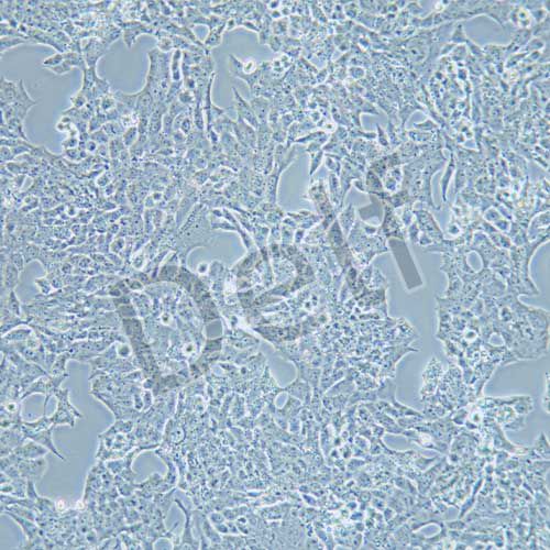 NCI-H295R 人腎上腺皮質(zhì)腺癌細胞