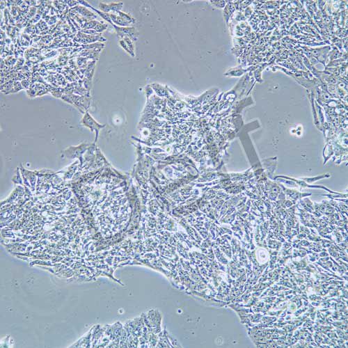 NCI-H358 人非小細(xì)胞肺癌細(xì)胞