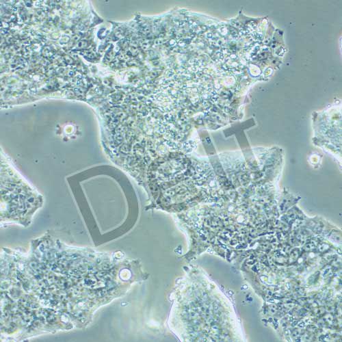 NCI-H508 人結(jié)腸直腸腺癌細(xì)胞