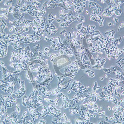 NCI-H520人肺鱗癌細(xì)胞