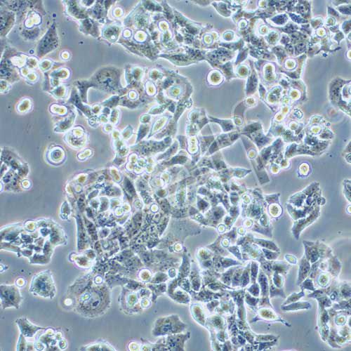 NCI-H520人肺鱗癌細(xì)胞