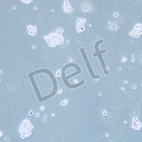 NCI-H524 人非小細(xì)胞肺癌細(xì)胞