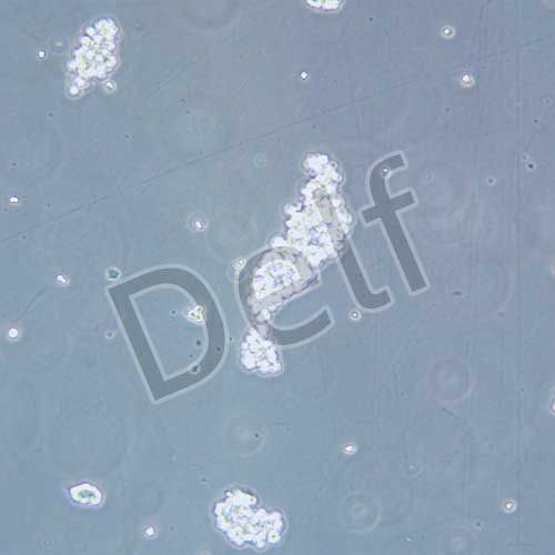 NCI-H524 人非小細(xì)胞肺癌細(xì)胞