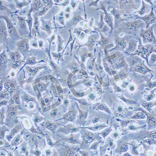 NCI-H661 人大細胞肺癌細胞