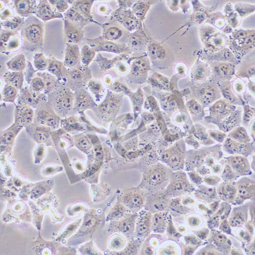 NCI-H1299 人非小細(xì)胞肺癌細(xì)胞