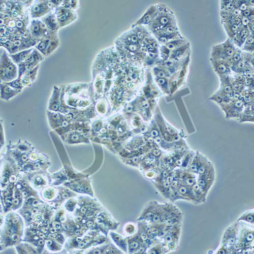 NCI-H1395 人肺腺癌細(xì)胞