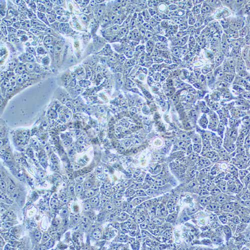 NCI-H1437 人肺癌細胞