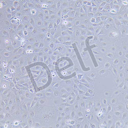 NCI-H1650 人非小細胞肺癌細胞