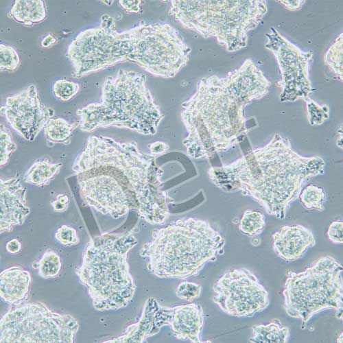NCI-H1688 人經(jīng)典小細(xì)胞肺癌細(xì)胞