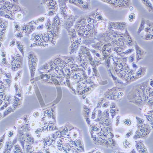 NCI-H1944 人肺癌細(xì)胞