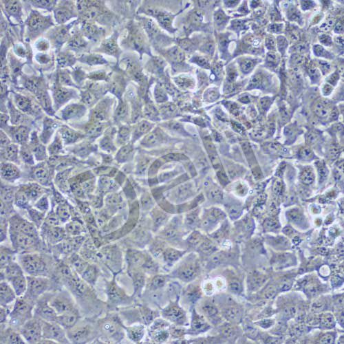 NCI-H1975 人肺腺癌細胞