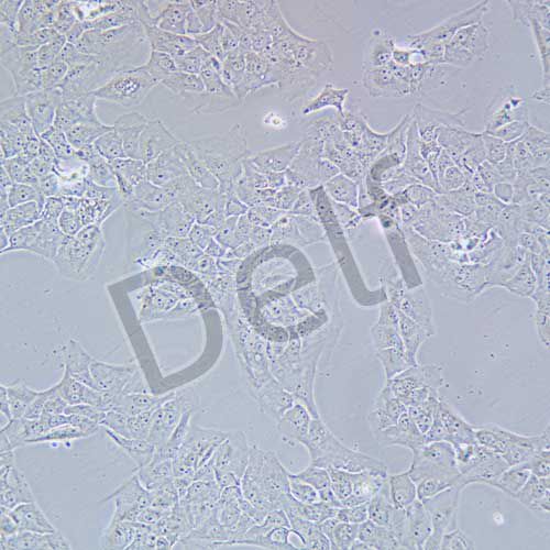 NCI-H2228 人肺癌細(xì)胞