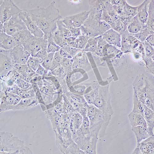 NCI-H2228 人肺癌細(xì)胞