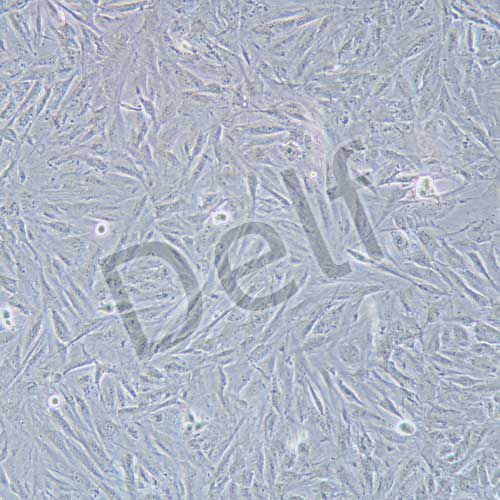 NCI-H2452 人間皮瘤細胞