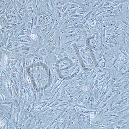 NCI-H2452 人間皮瘤細胞