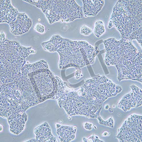 NCI-N87 人胃癌細(xì)胞
