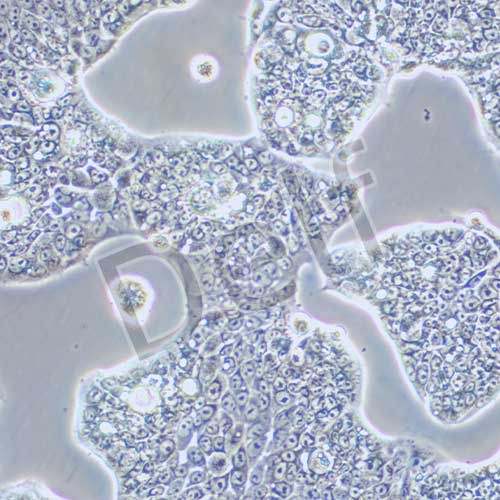 NCI-N87 人胃癌細(xì)胞