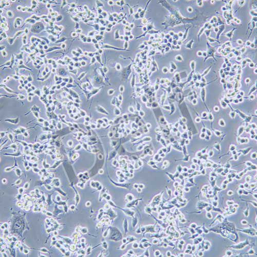 neuro-2a(N2A)小鼠腦神經(jīng)瘤細(xì)胞