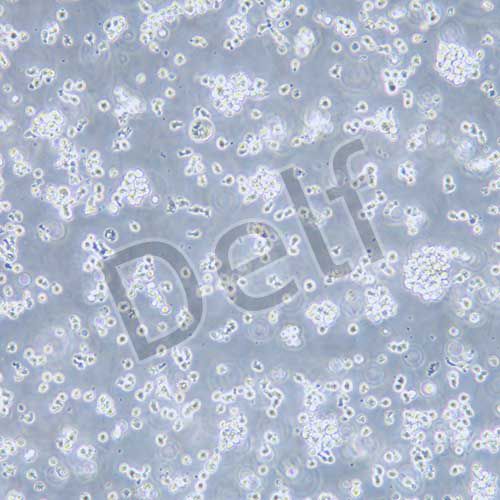 NK-92MI 人惡性非霍奇金淋巴瘤患者的自然殺傷細胞