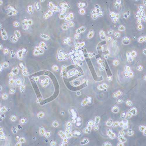 NK-92MI 人惡性非霍奇金淋巴瘤患者的自然殺傷細胞