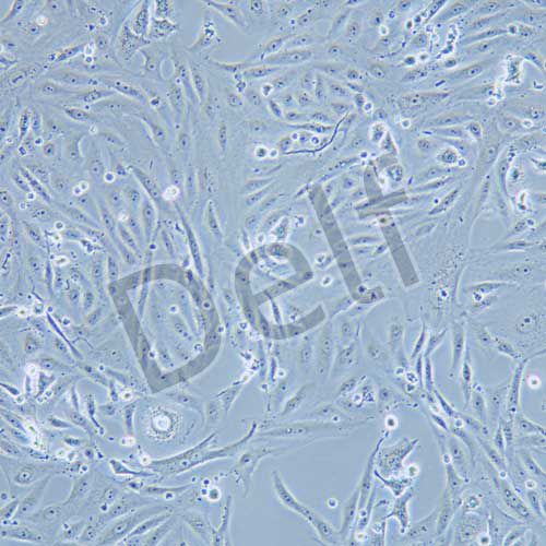 NOZ 人膽囊癌細(xì)胞