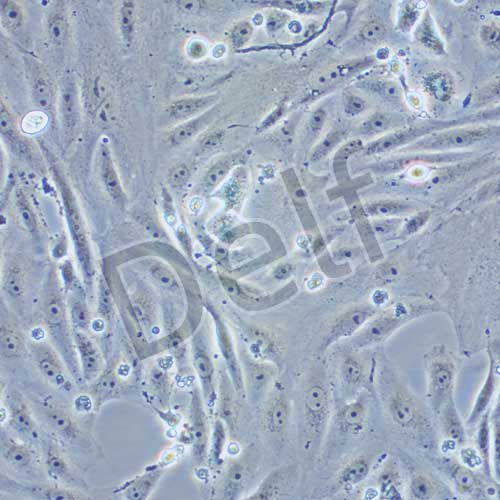 NOZ 人膽囊癌細(xì)胞