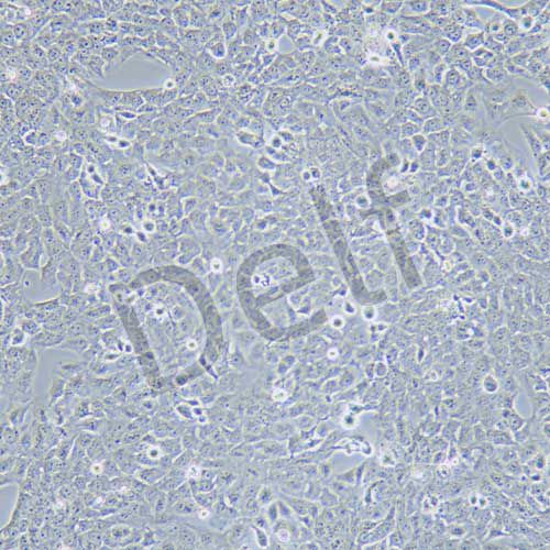 Nthy-ori 3-1 人甲狀腺正常細(xì)胞