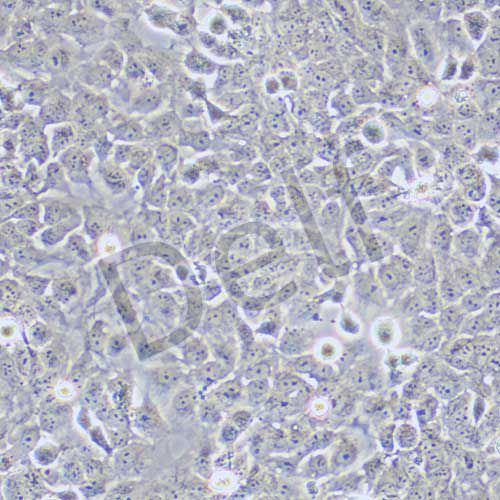 Nthy-ori 3-1 人甲狀腺正常細(xì)胞